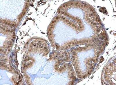 Immunohistochemistry-Paraffin: DDB1 Antibody [NBP1-33061]