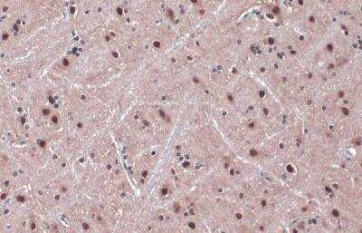 Immunohistochemistry-Paraffin: DDB1 Antibody [NBP1-33061]