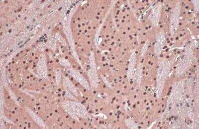 Immunohistochemistry-Paraffin: DDB1 Antibody [NBP1-33061]