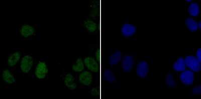 Immunocytochemistry/ Immunofluorescence: DDB1 Antibody (JU32-35) [NBP2-75465]