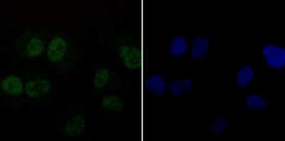 Immunocytochemistry/ Immunofluorescence: DDB1 Antibody (JU32-35) [NBP2-75465]