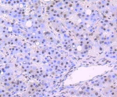 Immunohistochemistry-Paraffin: DDB1 Antibody (JU32-35) [NBP2-75465]
