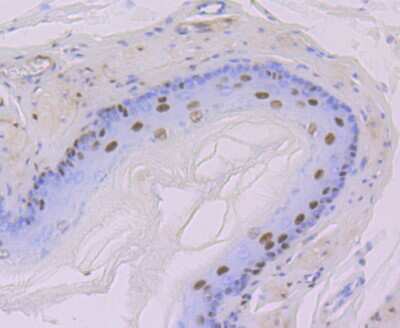 Immunohistochemistry-Paraffin: DDB1 Antibody (JU32-35) [NBP2-75465]