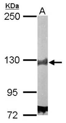 Western Blot: DDB1 Antibody [NBP1-33061]