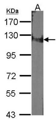 Western Blot: DDB1 Antibody [NBP1-33061]