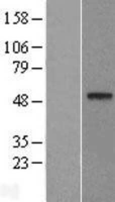 Western Blot: XPE/DDB2 Overexpression Lysate [NBL1-09764]