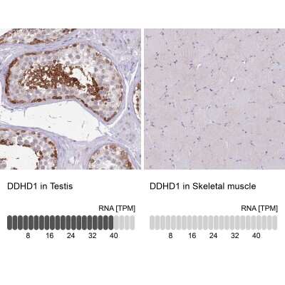 Immunohistochemistry-Paraffin: DDHD1 Antibody [NBP2-13903]