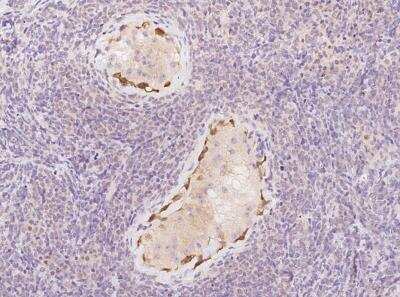 Immunohistochemistry-Paraffin: DDHD1 Antibody [NBP3-05949]