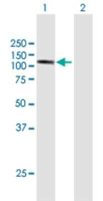 Western Blot: DDHD1 Antibody [H00080821-B01P]