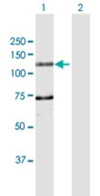 Western Blot: DDHD1 Antibody [H00080821-D01P]