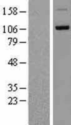 Western Blot: DDHD1 Overexpression Lysate [NBL1-09770]