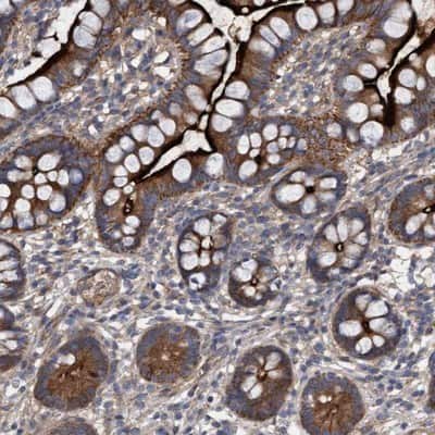 Immunohistochemistry-Paraffin: DDHD2 Antibody [NBP1-82965]