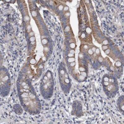 Immunohistochemistry-Paraffin: DDHD2 Antibody [NBP1-82967]