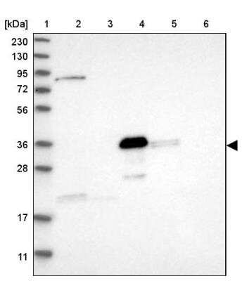 Western Blot: DDHD2 Antibody [NBP1-82965]