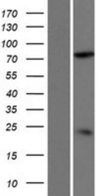 Western Blot: DDHD2 Overexpression Lysate [NBP2-10159]