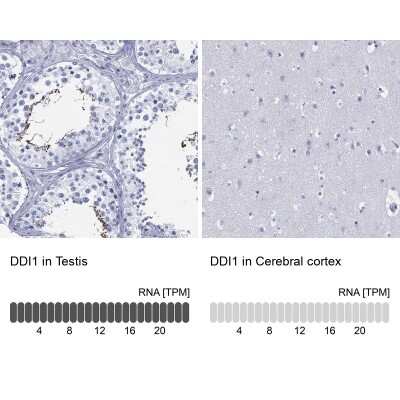 Immunocytochemistry/ Immunofluorescence: DDI1 Antibody [NBP3-17080]