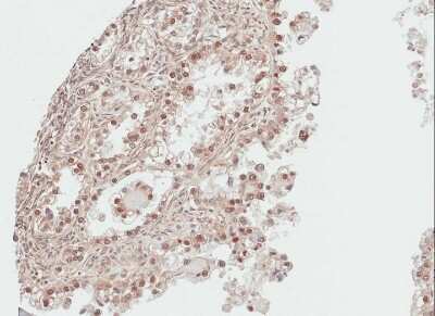 Immunohistochemistry-Paraffin: DDI1 Antibody [NBP1-31417]