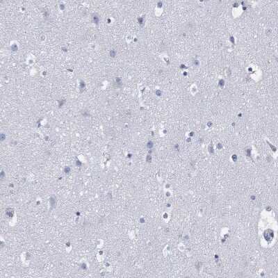 Immunohistochemistry-Paraffin: DDI1 Antibody [NBP3-17080]