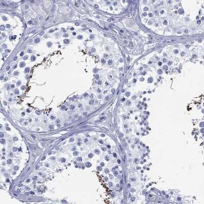 Immunohistochemistry-Paraffin: DDI1 Antibody [NBP3-17080]