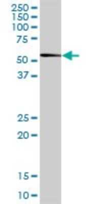 Western Blot: DDI1 Antibody [H00414301-B01P]