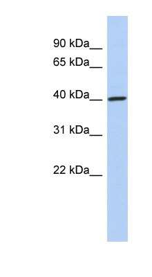 Western Blot: DDI1 Antibody [NBP1-56817]