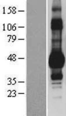 Western Blot: DDI1 Overexpression Lysate [NBP2-08952]