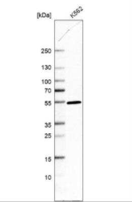 Western Blot: DDI2 Antibody [NBP2-47493]