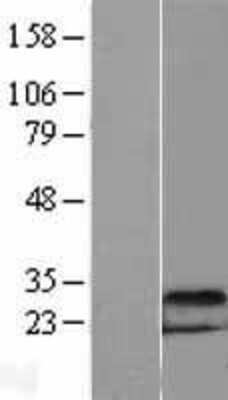 Western Blot: DDIT4 Overexpression Lysate [NBL1-09773]