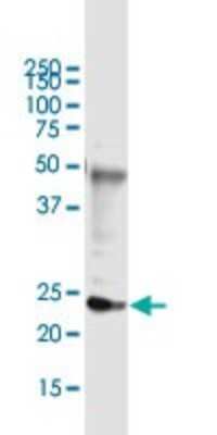 Immunoprecipitation: DDIT4L Antibody (2E6) [H00115265-M01]