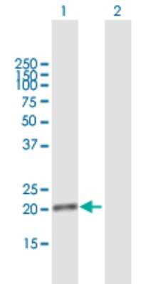 Western Blot: DDIT4L Antibody [H00115265-B01P]