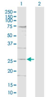 Western Blot: DDIT4L Antibody [H00115265-D01P]