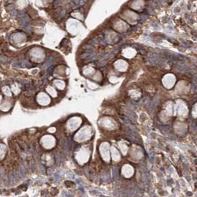 Immunohistochemistry-Paraffin: DDO Antibody [NBP1-85884]