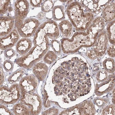 Immunohistochemistry-Paraffin: DDO Antibody [NBP2-32684]