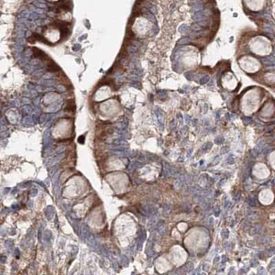 Immunohistochemistry-Paraffin: DDO Antibody [NBP2-32684]