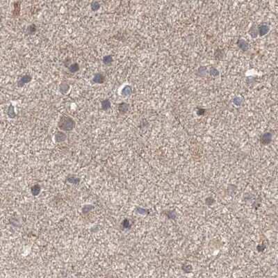 Immunohistochemistry-Paraffin: DDO Antibody [NBP2-32684]