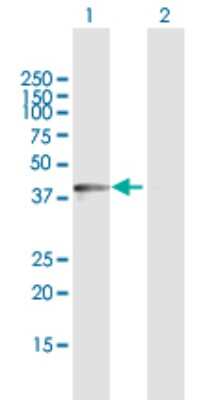 Western Blot: DDO Antibody [H00008528-D01P]