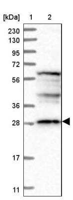 Western Blot: DDO Antibody [NBP1-85884]