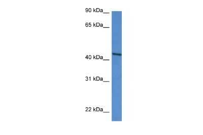 Western Blot: DDO Antibody [NBP3-10665]