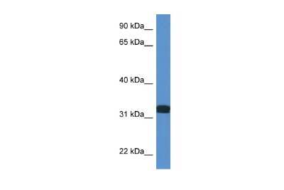 Western Blot: DDO Antibody [NBP3-10666]