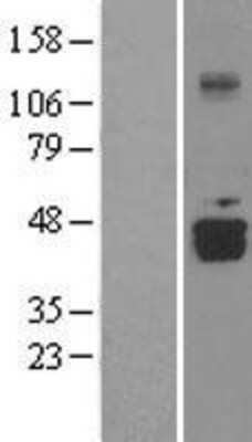 Western Blot: DDO Overexpression Lysate [NBL1-09775]