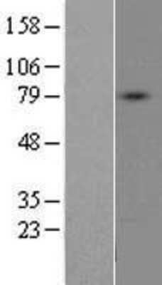 Western Blot: DDO Overexpression Lysate [NBP2-09798]