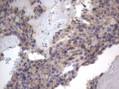 Immunohistochemistry: DDOST Antibody (OTI2B4) [NBP2-46439]