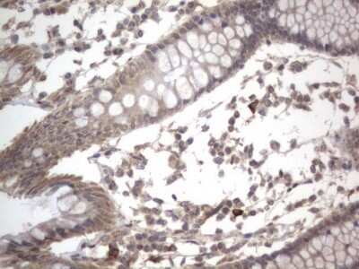 Immunohistochemistry: DDOST Antibody (OTI2B4) [NBP2-46439]