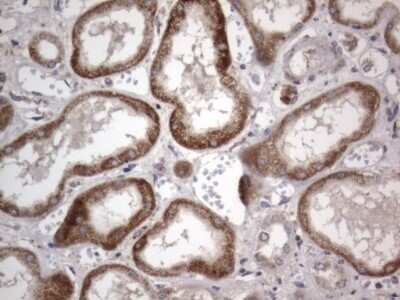 Immunohistochemistry: DDOST Antibody (OTI2B4) [NBP2-46439]