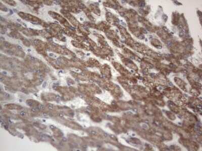 Immunohistochemistry: DDOST Antibody (OTI2B4) [NBP2-46439]