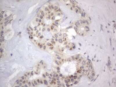 Immunohistochemistry: DDOST Antibody (OTI2B4) [NBP2-46439]
