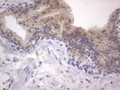 Immunohistochemistry: DDOST Antibody (OTI2B4) [NBP2-46439]
