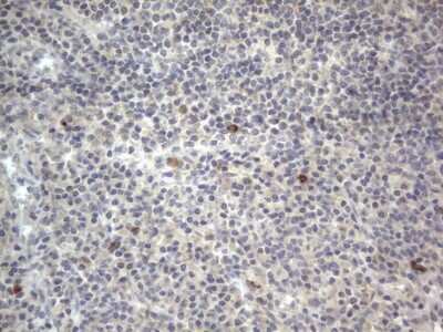 Immunohistochemistry: DDOST Antibody (OTI2B4) [NBP2-46439]