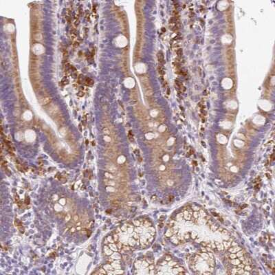 Immunohistochemistry-Paraffin: DDOST Antibody [NBP2-38560]