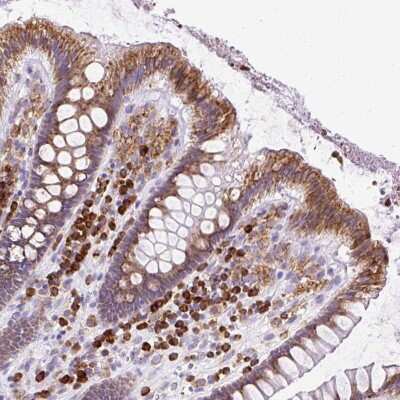 Immunohistochemistry: DDOST Antibody [NBP2-38681]